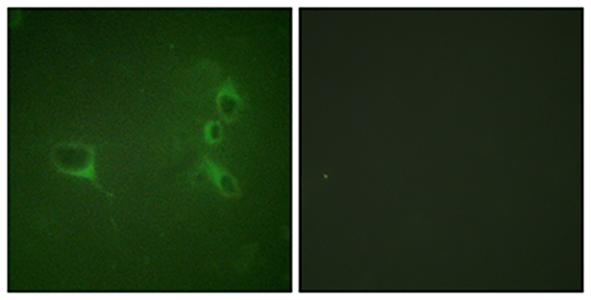 Bcr (phospho Tyr360) Rabbit Polyclonal Antibody | 兔多抗 | EnkiLife恩玑生命