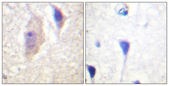 Bcr (phospho Tyr360) Rabbit Polyclonal Antibody | 兔多抗 | EnkiLife恩玑生命