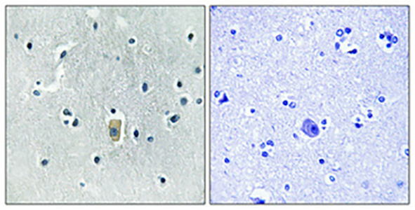 Bim (phospho Ser59) Rabbit Polyclonal Antibody | 兔多抗 | EnkiLife恩玑生命