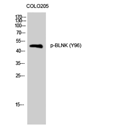BLNK (phospho Tyr96) Rabbit Polyclonal Antibody | 兔多抗 | EnkiLife恩玑生命