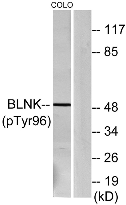 BLNK (phospho Tyr96) Rabbit Polyclonal Antibody | 兔多抗 | EnkiLife恩玑生命