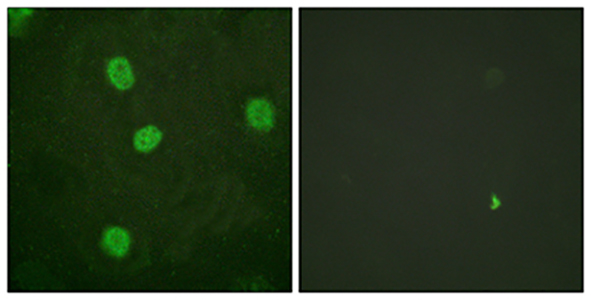 B-Myb (phospho Ser577) Rabbit Polyclonal Antibody | 兔多抗 | EnkiLife恩玑生命