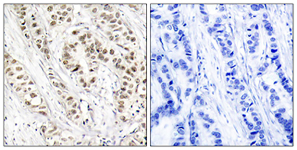 BRCA1 (phospho Ser1524) Rabbit Polyclonal Antibody | 兔多抗 | EnkiLife恩玑生命