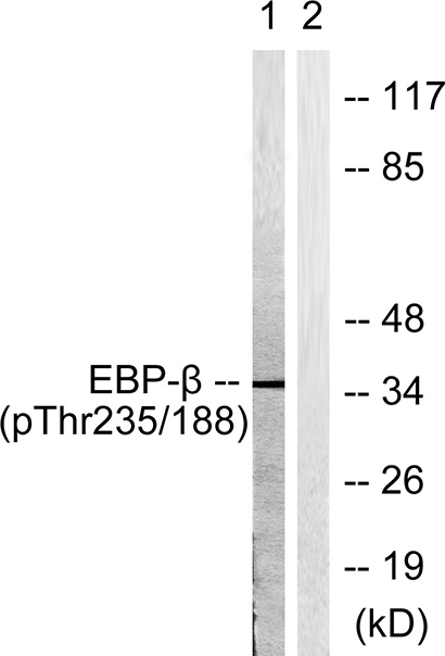 C/EBP β (phospho Thr235) Rabbit Polyclonal Antibody | 兔多抗 | EnkiLife恩玑生命