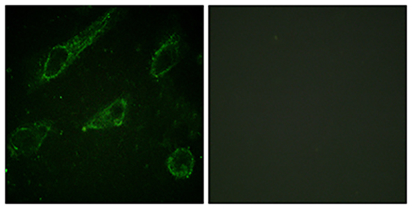c-Abl (phospho Tyr245) Rabbit Polyclonal Antibody | 兔多抗 | EnkiLife恩玑生命