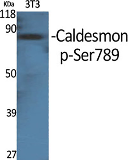 Caldesmon (phospho Ser789) Rabbit Polyclonal Antibody | 兔多抗 | EnkiLife恩玑生命