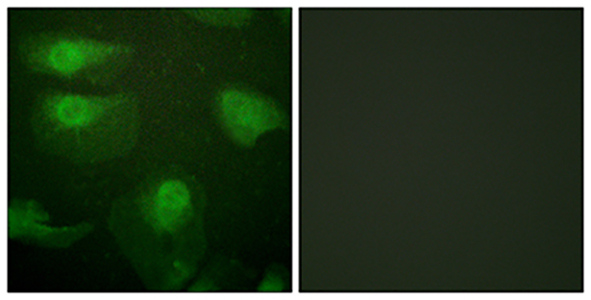 CaMKIα (phospho Thr177) Rabbit Polyclonal Antibody | 兔多抗 | EnkiLife恩玑生命