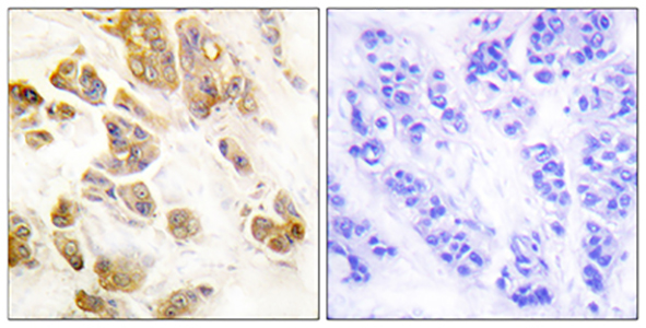 CaMKIα (phospho Thr177) Rabbit Polyclonal Antibody | 兔多抗 | EnkiLife恩玑生命