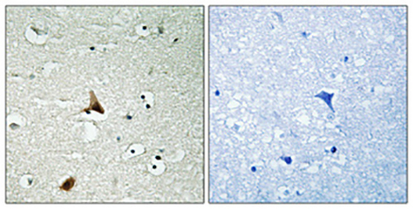 Caspase-1 (phospho Ser376) Rabbit Polyclonal Antibody | 兔多抗 | EnkiLife恩玑生命