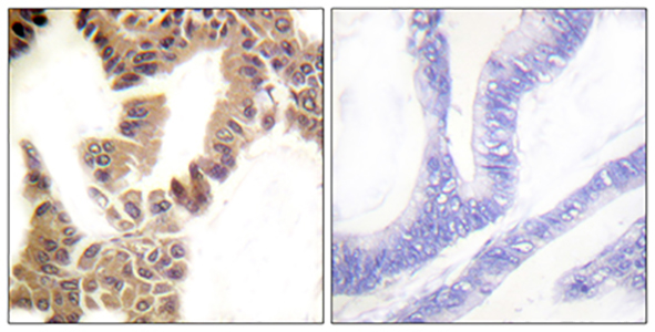 Caspase-2 (phospho Ser157) Rabbit Polyclonal Antibody | 兔多抗 | EnkiLife恩玑生命