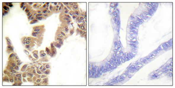 Caspase-2 (phospho Ser157) Rabbit Polyclonal Antibody | 兔多抗 | EnkiLife恩玑生命