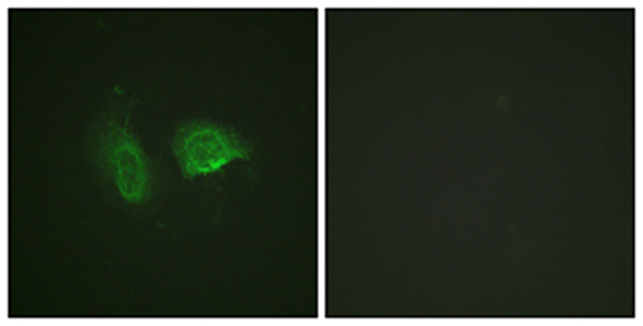 CaSR (phospho Thr888) Rabbit Polyclonal Antibody | 兔多抗 | EnkiLife恩玑生命