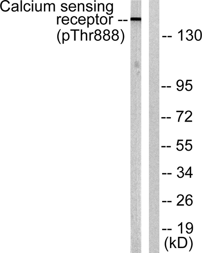 CaSR (phospho Thr888) Rabbit Polyclonal Antibody | 兔多抗 | EnkiLife恩玑生命