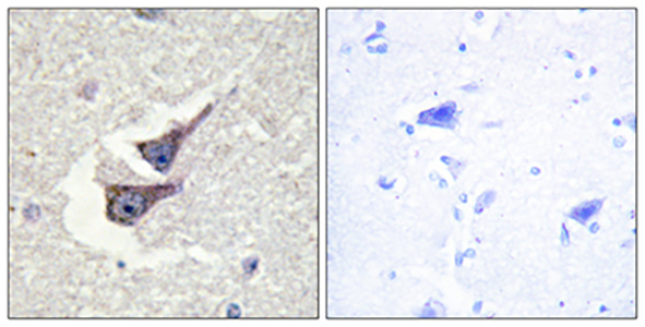 Catalase (phospho Tyr386) Rabbit Polyclonal Antibody | 兔多抗 | EnkiLife恩玑生命