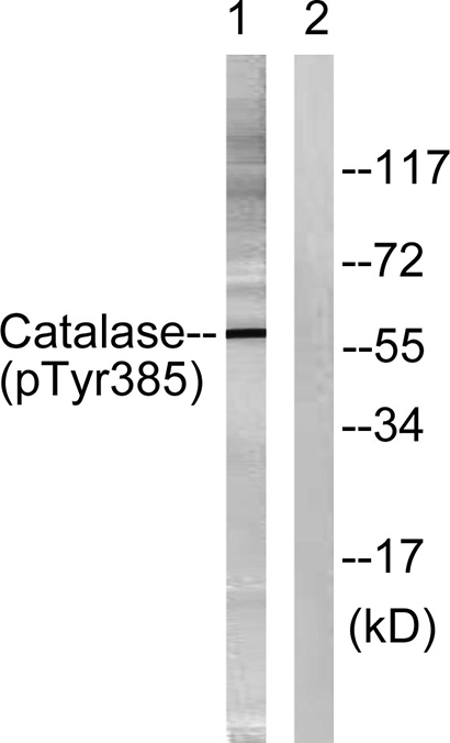 Catalase (phospho Tyr386) Rabbit Polyclonal Antibody | 兔多抗 | EnkiLife恩玑生命