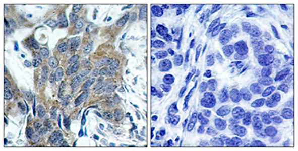 Catenin-β (phospho Ser33) Rabbit Polyclonal Antibody | 兔多抗 | EnkiLife恩玑生命