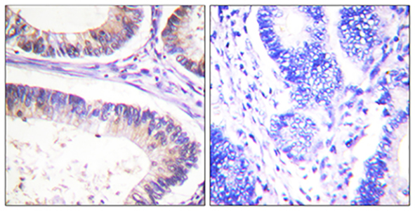 Cbl (phospho Tyr674) Rabbit Polyclonal Antibody | 兔多抗 | EnkiLife恩玑生命