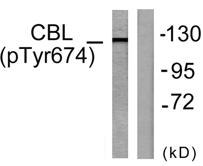Cbl (phospho Tyr674) Rabbit Polyclonal Antibody | 兔多抗 | EnkiLife恩玑生命