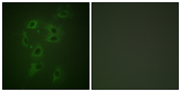 Cbl (phospho Tyr700) Rabbit Polyclonal Antibody | 兔多抗 | EnkiLife恩玑生命