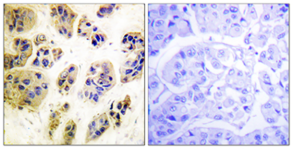 Cbl (phospho Tyr700) Rabbit Polyclonal Antibody | 兔多抗 | EnkiLife恩玑生命