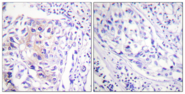 Cbl (phospho Tyr774) Rabbit Polyclonal Antibody | 兔多抗 | EnkiLife恩玑生命