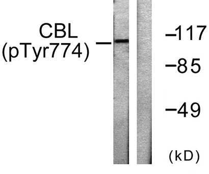 Cbl (phospho Tyr774) Rabbit Polyclonal Antibody | 兔多抗 | EnkiLife恩玑生命