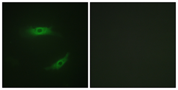 CD4 (phospho Ser433) Rabbit Polyclonal Antibody | 兔多抗 | EnkiLife恩玑生命