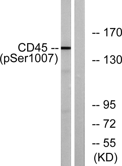 CD45 (phospho Ser1007) Rabbit Polyclonal Antibody | 兔多抗 | EnkiLife恩玑生命