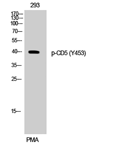 CD5 (phospho Tyr453) Rabbit Polyclonal Antibody | 兔多抗 | EnkiLife恩玑生命