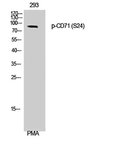 CD71 (phospho Ser24) Rabbit Polyclonal Antibody | 兔多抗 | EnkiLife恩玑生命