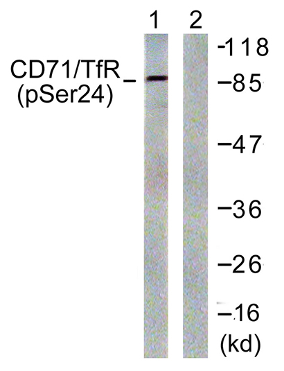 CD71 (phospho Ser24) Rabbit Polyclonal Antibody | 兔多抗 | EnkiLife恩玑生命