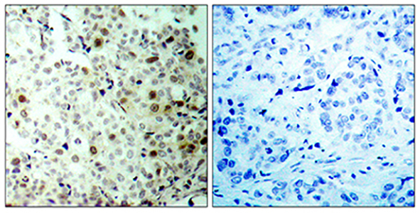Cdc2 (phospho Thr161) Rabbit Polyclonal Antibody | 兔多抗 | EnkiLife恩玑生命