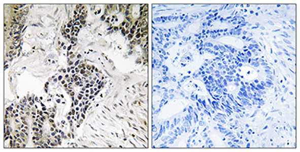 Cdc25C (phospho Ser198) Rabbit Polyclonal Antibody | 兔多抗 | EnkiLife恩玑生命