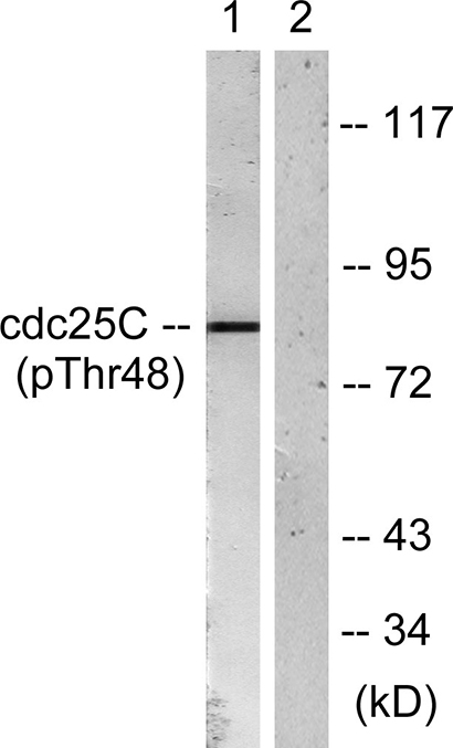 Cdc25C (phospho Thr48) Rabbit Polyclonal Antibody | 兔多抗 | EnkiLife恩玑生命
