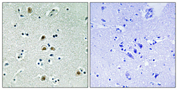 Cdk1/Cdc2 (phospho Thr161) Rabbit Polyclonal Antibody | 兔多抗 | EnkiLife恩玑生命