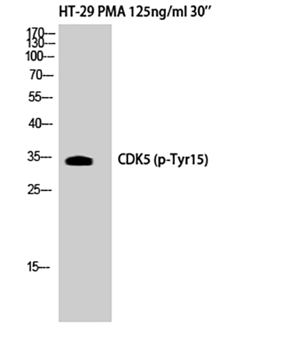Cdk5 (phospho Tyr15) Rabbit Polyclonal Antibody | 兔多抗 | EnkiLife恩玑生命