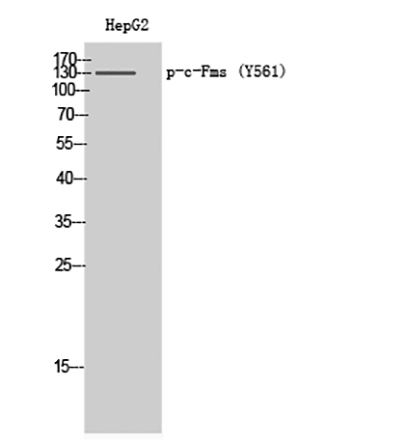 c-Fms (phospho Tyr561) Rabbit Polyclonal Antibody | 兔多抗 | EnkiLife恩玑生命