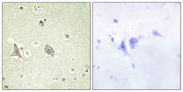 c-Fms (phospho Tyr723) Rabbit Polyclonal Antibody | 兔多抗 | EnkiLife恩玑生命