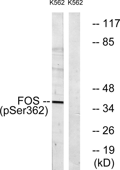 c-Fos (phospho Ser362) Rabbit Polyclonal Antibody | 兔多抗 | EnkiLife恩玑生命