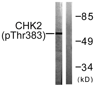 Chk2 (phospho Thr383) Rabbit Polyclonal Antibody | 兔多抗 | EnkiLife恩玑生命