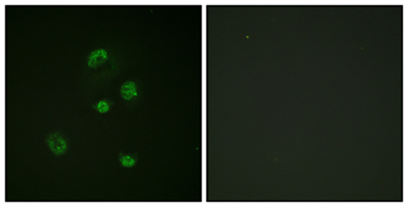 CHOP (phospho Ser30) Rabbit Polyclonal Antibody | 兔多抗 | EnkiLife恩玑生命