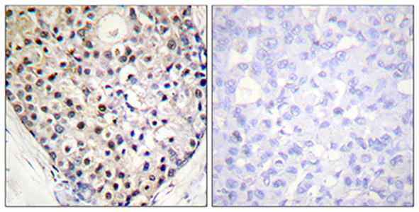 CHOP (phospho Ser30) Rabbit Polyclonal Antibody | 兔多抗 | EnkiLife恩玑生命