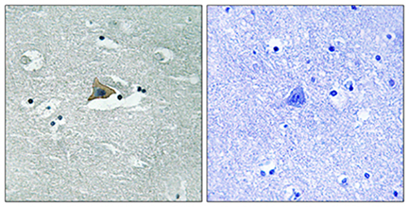 Claudin-5 (phospho Tyr217) Rabbit Polyclonal Antibody | 兔多抗 | EnkiLife恩玑生命