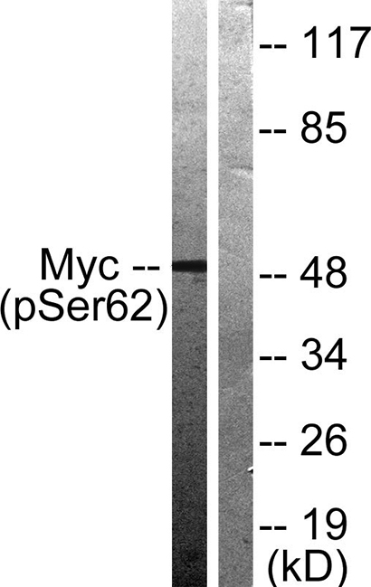 c-Myc (phospho Ser62) Rabbit Polyclonal Antibody | 兔多抗 | EnkiLife恩玑生命