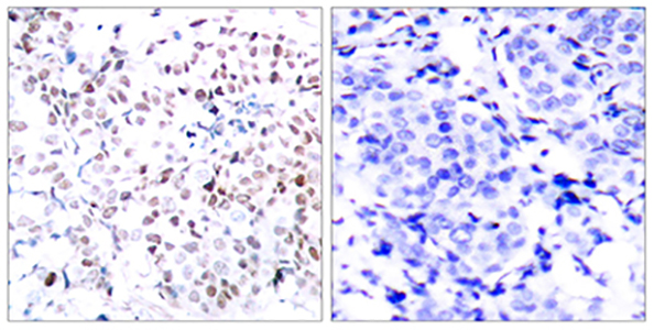 c-Myc (phospho Thr358) Rabbit Polyclonal Antibody | 兔多抗 | EnkiLife恩玑生命