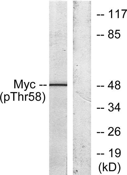c-Myc (phospho Thr58) Rabbit Polyclonal Antibody | 兔多抗 | EnkiLife恩玑生命