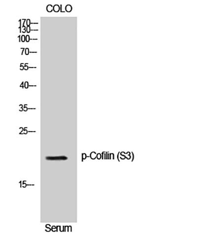 Cofilin (phospho Ser3) Rabbit Polyclonal Antibody | 兔多抗 | EnkiLife恩玑生命