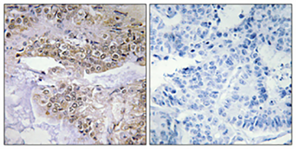Cofilin (phospho Ser3) Rabbit Polyclonal Antibody | 兔多抗 | EnkiLife恩玑生命
