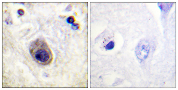 Connexin 43 (phospho Ser261) Rabbit Polyclonal Antibody | 兔多抗 | EnkiLife恩玑生命