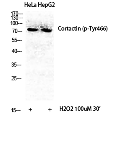 Cortactin (phospho Tyr466) Rabbit Polyclonal Antibody | 兔多抗 | EnkiLife恩玑生命
